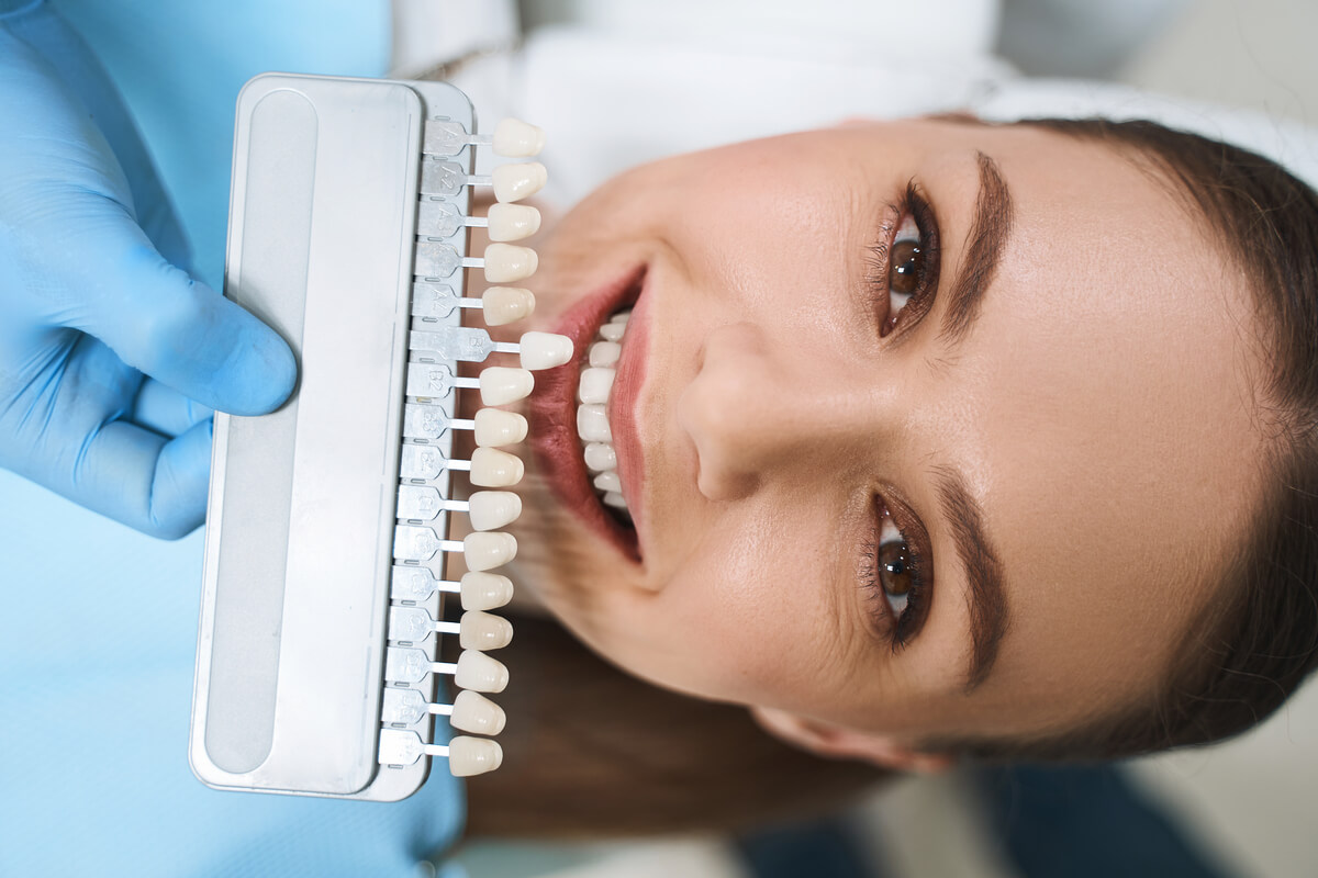 Ventajas e inconvenientes de las carillas dentales