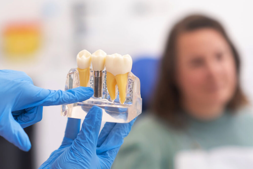 ¿Cuánto cuesta un implante dental en Granada? Precio 2026