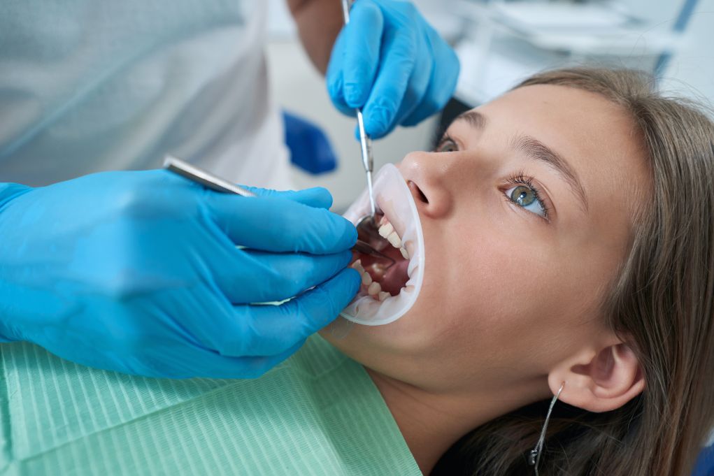 ¿Cómo sé si tengo periodontitis? 7 síntomas de alarma